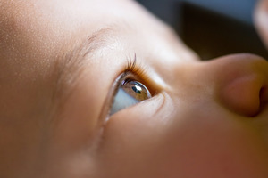 Close-up of eye of child with myopia
