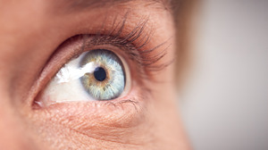Close-up of a diabetic patient’s eye